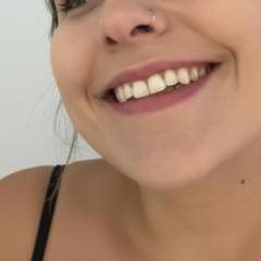 EmsSparksx