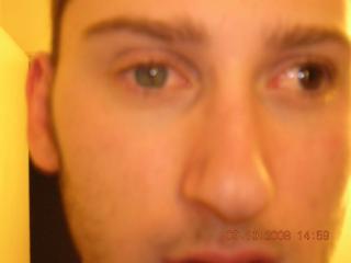 My different colored eyes 1 of 4