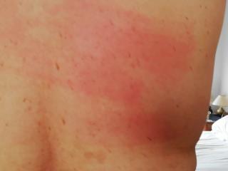 back part second part