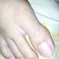 My long toes-malay