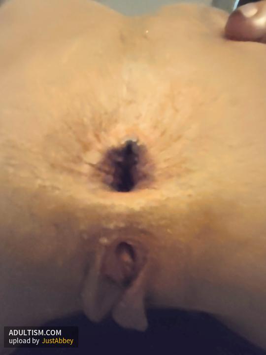 Image 4 of 5