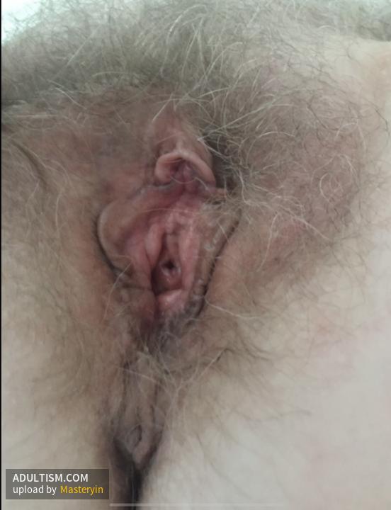 Image 1 of 11