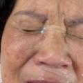 New Facial