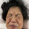New Facial