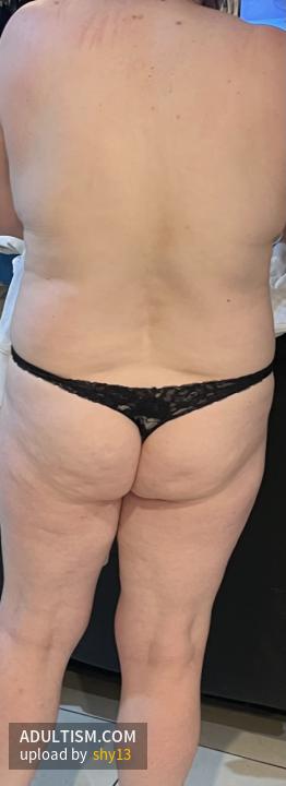 Image 3 of 20