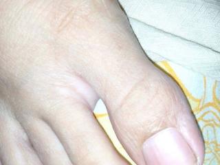 Malay feet n toes 2 of 16