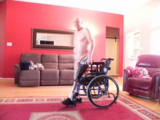 Tom Wearing His Prosthesis on Nov 2022. 6 of 18