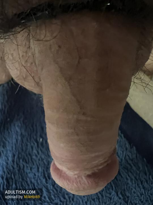 Image 3 of 5