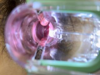 Vaginal inspection request 9 of 11