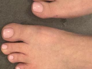 Wife’s pretty toes 2 of 6