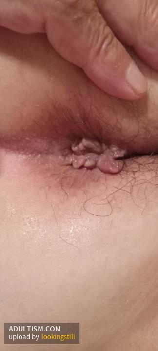 Image 2 of 4