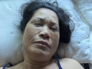 Blue Shirt Facial 16 of 20