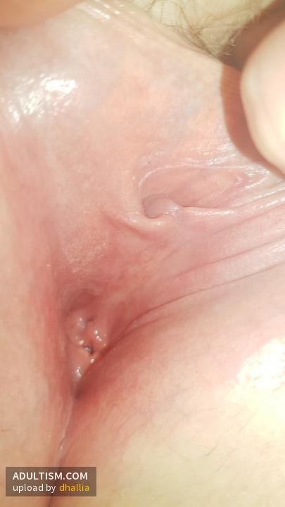 Image 5 of 6