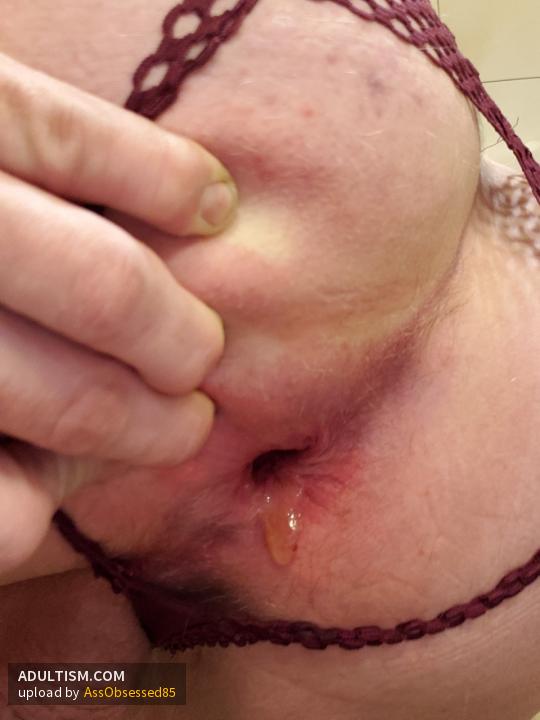 Image 2 of 11