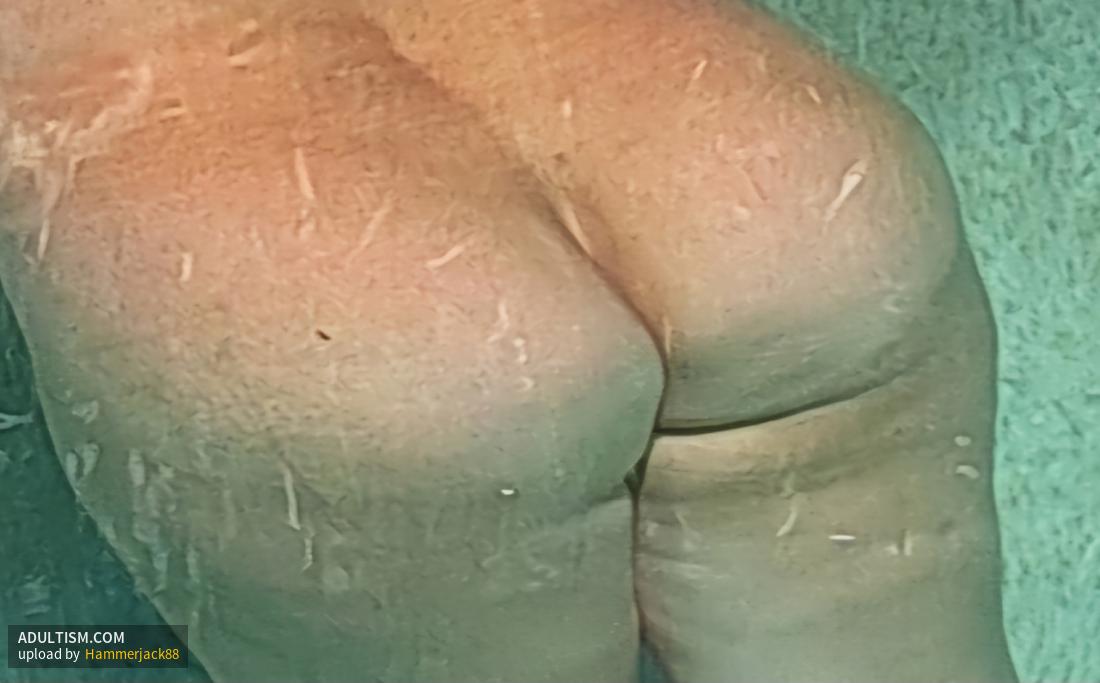 Image 2 of 5