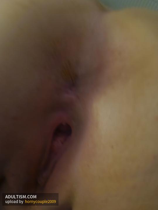 Image 2 of 5
