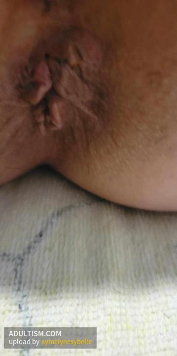 Image 7 of 11
