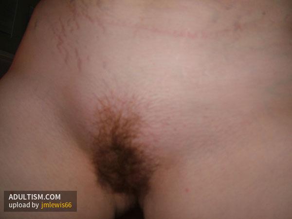 Image 3 of 11