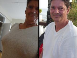 Befor and after female hormon injections 4 of 8