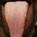 tongue83
