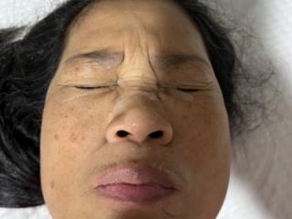 Last Night’s Facial 7 of 20