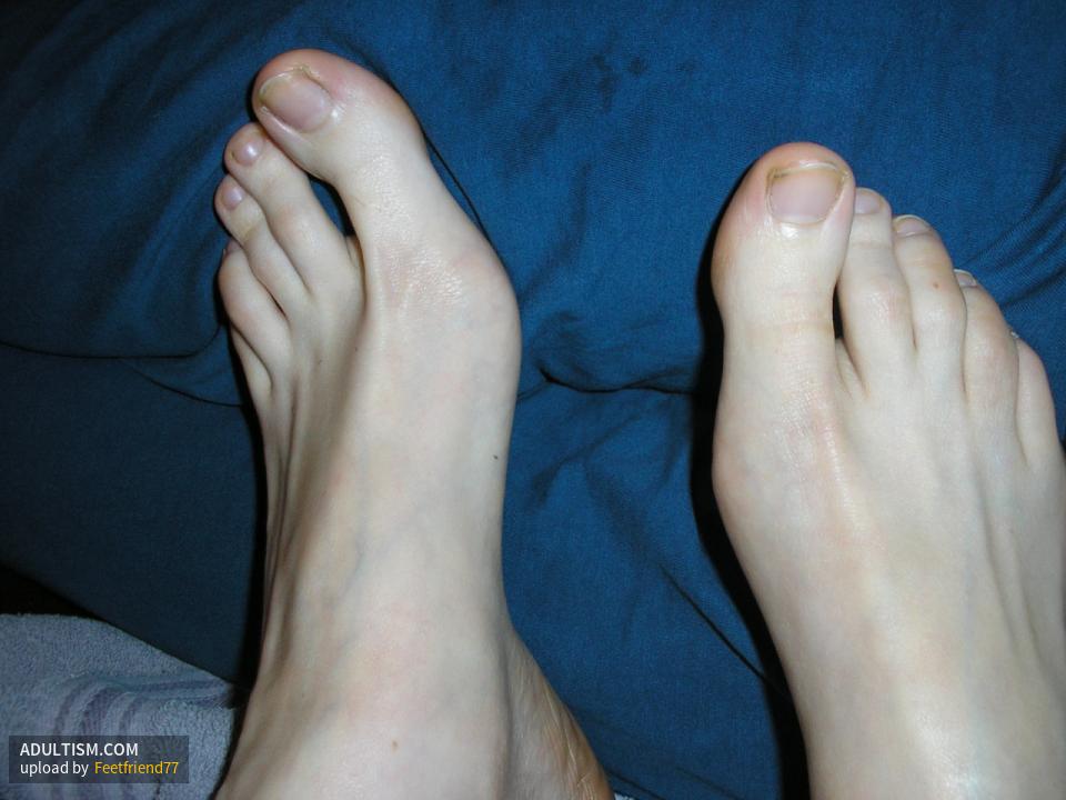Image 1 of 11