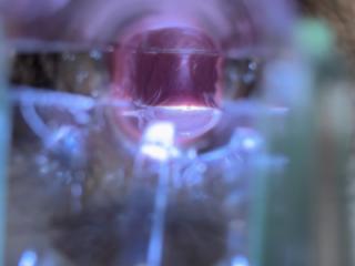 Vaginal inspection request 7 of 11