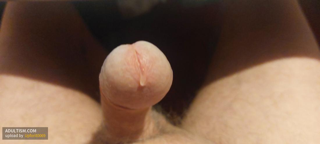 Image 1 of 11